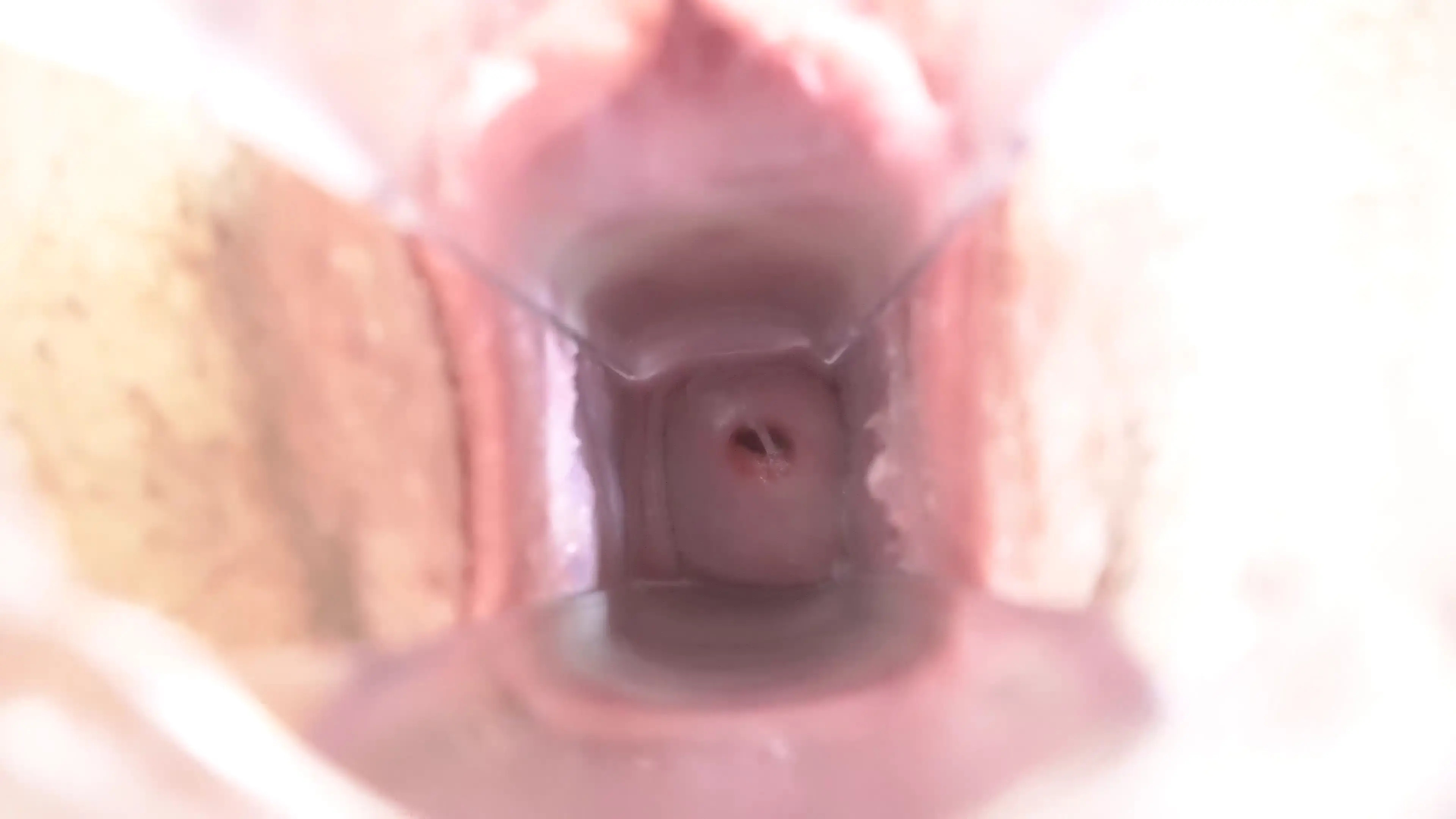 Exclusive Leak: AshAnn999 - My Ovulation Cervix And Ovulation Gusset - Stream in FullHD | Hotleakxxx.com