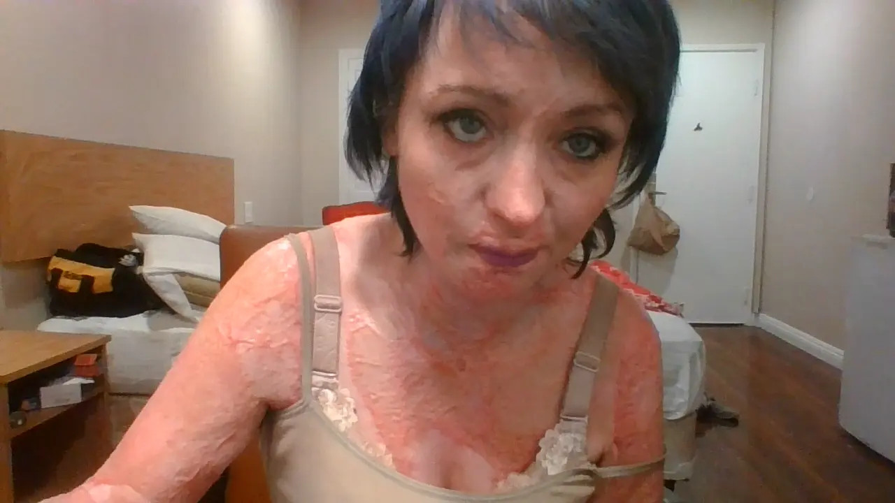 Exclusive Leak: nickie wilson - this is the new me since accident - Stream in FullHD | Hotleakxxx.com