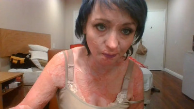 nickie wilson - this is the new me since accident