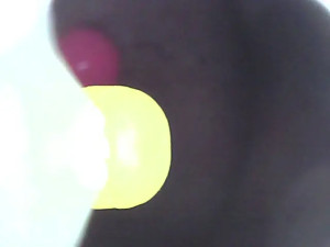 BentleyRoseBBW - Endoscopy of mouth, tonsils,uvulaclip