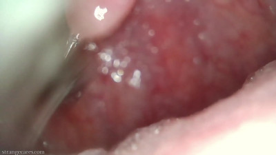 strangecares - uvula endoscopy & metal chopsticks