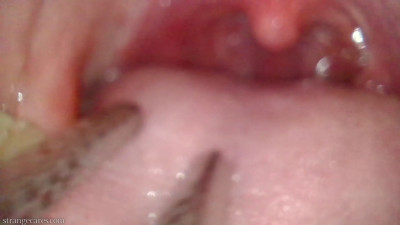 strangecares - uvula play with a chopstick