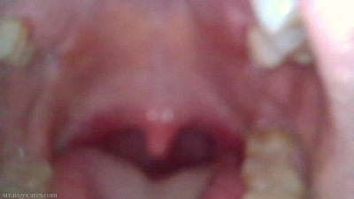 strangecares - endoscope uvula play
