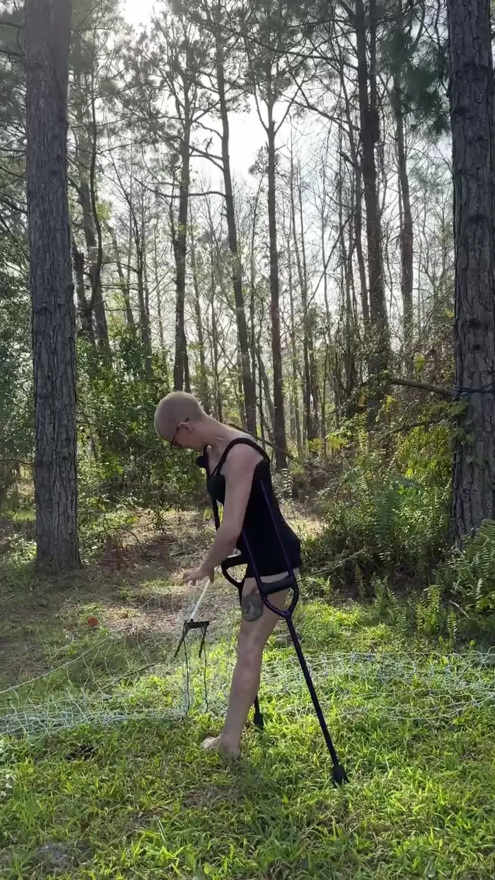 Exclusive Leak: Lunaskinkyden - Strechin in the woods - Stream in FullHD | Hotleakxxx.com