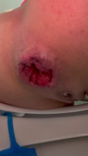 iamRose - Rose Mia Out push hard prolapse